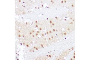 Immunohistochemistry of paraffin-embedded rat brain using SMOX Rabbit pAb (ABIN6132875, ABIN6148142, ABIN6148143 and ABIN6215369) at dilution of 1:100 (40x lens). (SMOX antibody  (AA 1-200))
