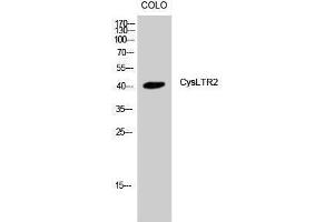Western Blotting (WB) image for anti-Cysteinyl Leukotriene Receptor 2 (CYSLTR2) (C-Term) antibody (ABIN3184210) (CasLTR2 antibody  (C-Term))
