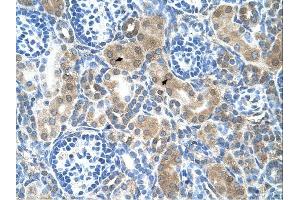 CBS antibody was used for immunohistochemistry at a concentration of 4-8 ug/ml. (CBS antibody  (N-Term))