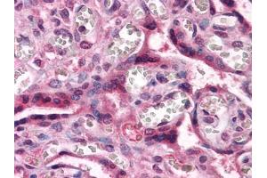 Immunohistochemical analysis of paraffin-embedded human Placenta tissues using CTNNB1 antibody (CTNNB1 antibody)