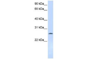 WB Suggested Anti-DCK Antibody Titration: 0. (DCK antibody  (Middle Region))