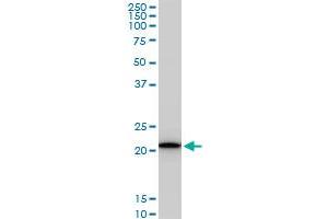 RPS5 monoclonal antibody (M02), clone 4H3. (RPS5 antibody  (AA 106-204))