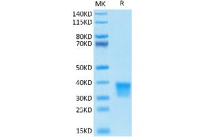 Oncostatin M Protein (OSM) (AA 26-221) (His-Avi Tag)