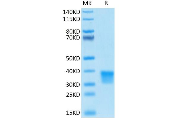 Oncostatin M Protein (OSM) (AA 26-221) (His-Avi Tag)