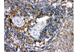 Anti- TGM2 Picoband antibody, IHC(P) IHC(P): Rat Spleen Tissue (Transglutaminase 2 antibody  (N-Term))
