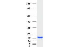 Western Blotting (WB) image for ADP-Ribosylation Factor 6 (ARF6) protein (Myc-DYKDDDDK Tag) (ABIN2714430)