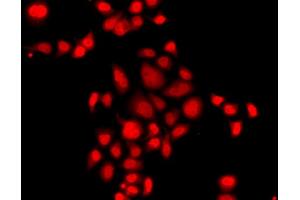 Immunofluorescence analysis of A549 cells using MLF1 antibody. (MLF1 antibody)