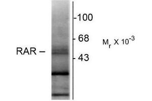 Western Blotting (WB) image for anti-Retinoic Acid Receptor, beta (RARB) (N-Term) antibody (ABIN371838) (Retinoic Acid Receptor beta antibody  (N-Term))