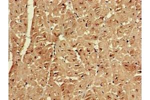 Immunohistochemistry of paraffin-embedded human heart tissue using ABIN7151606 at dilution of 1:100 (Emerin antibody  (AA 1-222))