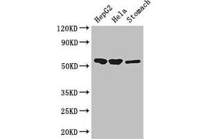 Western Blot Positive WB detected in: HepG2 whole cell lysate, Hela whole cell lysate, Mouse stomach tissue All lanes: SLC37A2 antibody at 3 μg/mL Secondary Goat polyclonal to rabbit IgG at 1/50000 dilution Predicted band size: 55, 43, 14 kDa Observed band size: 55 kDa (SLC37A2 antibody  (AA 46-84))