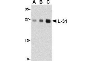 Western blot analysis of IL-31 in human skeletal muscle tissue lysate with AP30423PU-N IL-31 antibody at (A) 2. (IL-31 antibody  (Intermediate Domain))
