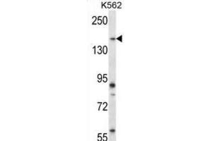 Western Blotting (WB) image for anti-Pseudopodium-Enriched Atypical Kinase 1 (PEAK1) antibody (ABIN2998316)