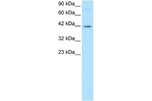 Western Blotting (WB) image for anti-FOS-Like Antigen 2 (FOSL2) (Middle Region) antibody (ABIN2777246)