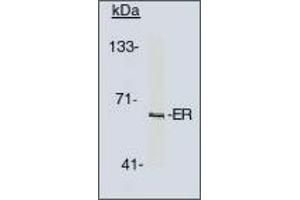 Image no. 1 for anti-Estrogen Receptor 1 (ESR1) antibody (ABIN201714) (Estrogen Receptor alpha antibody)
