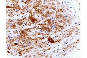 Rat cerebellum, zinc-fixed paraffin embedded tissue (left), 40X (Clathrin antibody  (AA 4-171))
