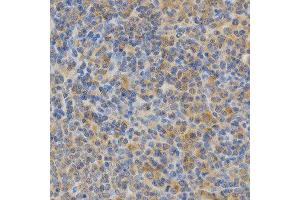 Immunohistochemistry (IHC) image for anti-Protein Kinase C, epsilon (PRKCE) (AA 488-737) antibody (ABIN3022942) (PKC epsilon antibody  (AA 488-737))