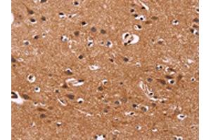 The image on the left is immunohistochemistry of paraffin-embedded Human brain tissue using ABIN7128511(ARL4A Antibody) at dilution 1/50, on the right is treated with fusion protein.