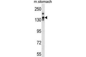 Western Blotting (WB) image for anti-Leucine Rich Repeat Containing 16A (LRRC16A) antibody (ABIN3000050)
