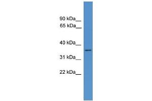 WB Suggested Anti-HNMT Antibody Titration: 0. (HNMT antibody  (N-Term))