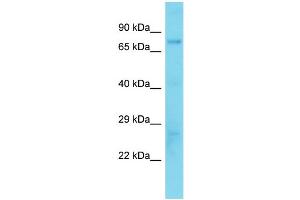Host:  Rabbit  Target Name:  Foxk1  Sample Type:  Mouse Liver lysates  Antibody Dilution:  1. (Foxk1 antibody  (Middle Region))