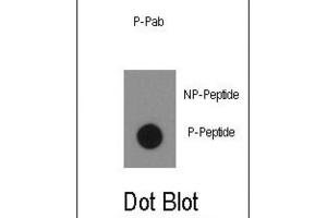 Dot Blot (DB) image for anti-C-Abl Oncogene 1, Non-Receptor tyrosine Kinase (ABL1) (pTyr134) antibody (ABIN3001743) (ABL1 antibody  (pTyr134))