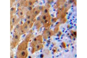 Used in DAB staining on fromalin fixed paraffin-embedded Liver tissue (IL16 antibody  (AA 1203-1322))