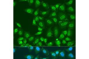 Immunofluorescence analysis of U2OS cells using PLCD4 Polyclonal Antibody at dilution of 1:100. (PLCD4 antibody)