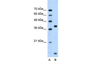 Western Blotting (WB) image for anti-FXYD Domain Containing Ion Transport Regulator 5 (FXYD5) antibody (ABIN2461114) (FXYD5 antibody)