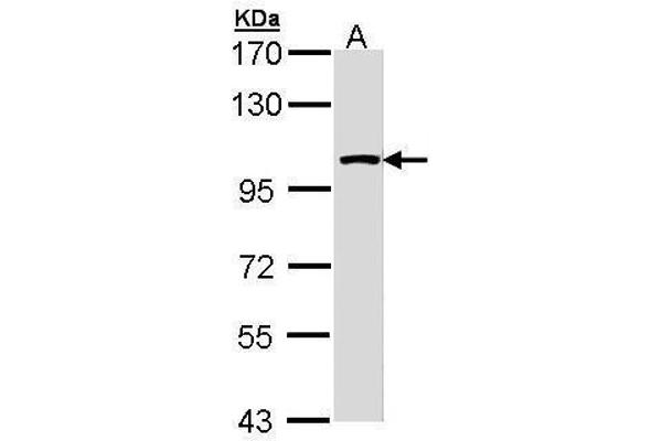 LARS2 antibody