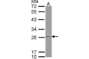 WB Image Sample (30 ug of whole cell lysate) A: Molt-4 , 12% SDS PAGE antibody diluted at 1:1000 (ATP Synthase B1 (Center) antibody)