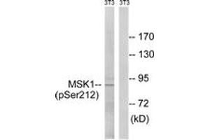 Western blot analysis of extracts from NIH-3T3 cells treated with EGF 200ng/ml 5', using MSK1 (Phospho-Ser212) Antibody. (MSK1 antibody  (pSer212))