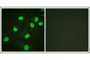 Immunofluorescence analysis of HeLa cells, using Histone H4 (Acetyl-Lys5) Antibody. (Histone H4 antibody  (acLys5))