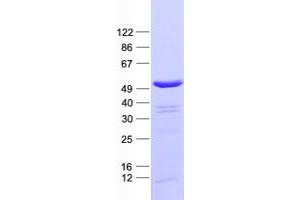 Validation with Western Blot (PABPC5 Protein (His tag))