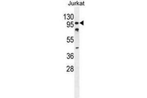CWC22 Antibody (N-term) western blot analysis in Jurkat cell line lysates (35µg/lane).