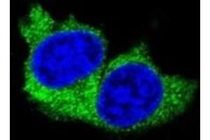 Confocal immunofluorescent analysis of MMP1 antibody with MDA-MB231 cells followed by Alexa Fluor 488-conjugated goat anti-rabbit lgG (green). (MMP1 antibody  (AA 317-347))