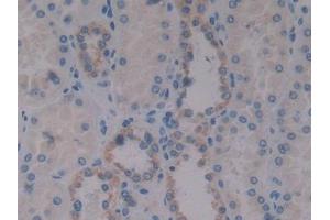DAB staining on IHC-P; Samples: Human Kidney Tissue (Insulin Like Protein 3 (AA 2-129) antibody)