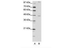 Image no. 1 for anti-Nuclear Receptor Subfamily 2, Group F, Member 2 (NR2F2) (AA 311-360) antibody (ABIN202470) (NR2F2 antibody  (AA 311-360))