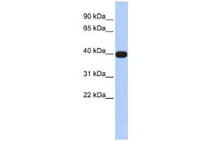 WB Suggested Anti-LMX1A Antibody Titration:  0.