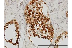 Image no. 1 for anti-Deleted in Azoospermia 1 (DAZ1) (AA 21-121) antibody (ABIN598640) (DAZ1 antibody  (AA 21-121))