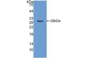 Detection of Recombinant CENPF, Human using Polyclonal Antibody to Centromere Protein F (CENPF) (CENPF antibody  (AA 436-637))