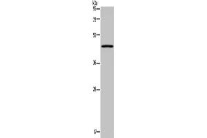 Gel: 8 % SDS-PAGE, Lysate: 40 μg, Lane: Mouse lung tissue, Primary antibody: ABIN7130211(MECP2 Antibody) at dilution 1/300, Secondary antibody: Goat anti rabbit IgG at 1/8000 dilution, Exposure time: 3 minutes