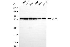 anti-Ewing Tumor-Associated Antigen 1 (ETAA1) antibody