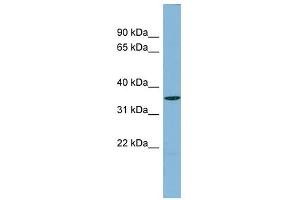 UCHL5 antibody used at 1 ug/ml to detect target protein. (UCHL5 antibody  (Middle Region))