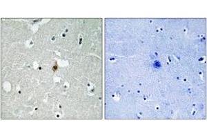 Immunohistochemistry analysis of paraffin-embedded human brain tissue, using E2A (Ab-355) Antibody. (TCF3 antibody  (AA 321-370))