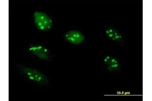 Immunofluorescence of purified MaxPab antibody to RRS1 on HeLa cell. (RRS1 antibody  (AA 1-365))