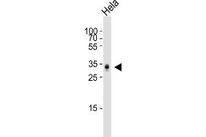 HeLa Cell lysates, probed with PPT1 (1117CT11. (PPT1 antibody)