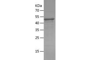 Western Blotting (WB) image for SET Domain Containing 1B (SETD1B) (AA 350-459) protein (His-IF2DI Tag) (ABIN7125069) (SETD1B Protein (AA 350-459) (His-IF2DI Tag))