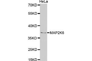 Western blot analysis of extracts of HeLa cells, using MAP2K6 antibody. (MAP2K6 antibody)