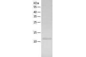 Western Blotting (WB) image for GLI Pathogenesis-Related 2 (GLIPR2) (AA 1-154) protein (His tag) (ABIN7288810) (GLIPR2 Protein (AA 1-154) (His tag))