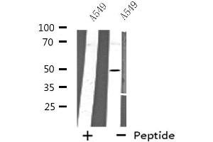 Western blot analysis of extracts from A549 cells using CHRNA10 antibody. (CHRNA10 antibody  (C-Term))